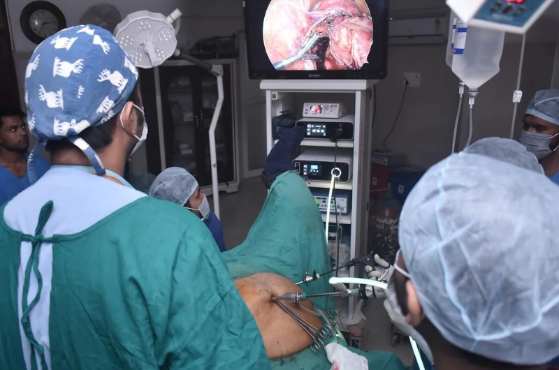 Laparoscopy and minimally invasive surgery